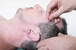 Medical Acupuncture - Level 1 - February London